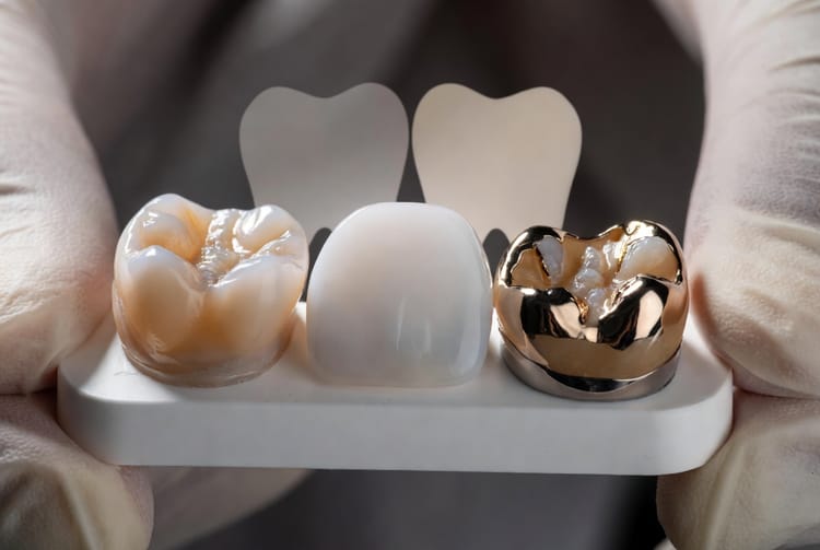The Dental Crown Materials: Porcelain vs. Zirconia vs. Metal
