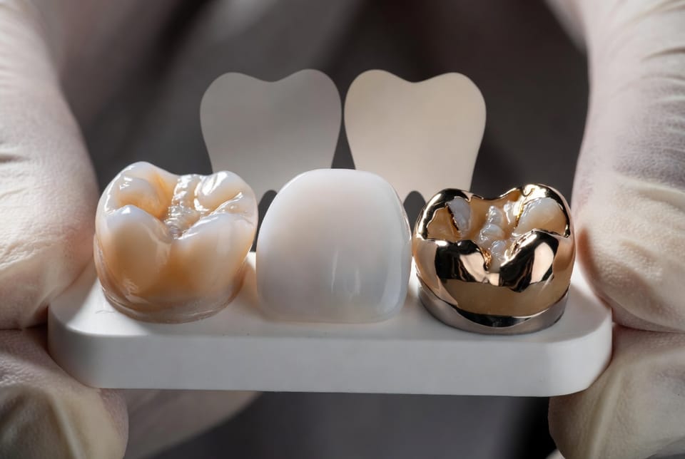 The Dental Crown Materials: Porcelain vs. Zirconia vs. Metal